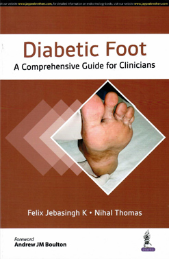 Diabetic Foot – A Comprehensive Guide for Clinicians